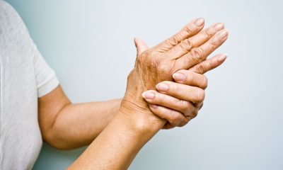 25924026 hands rheumatoid arthritis.jpg