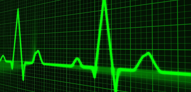 6401 electrocardiogram 620x300.png