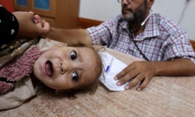 2024 08 18T111933Z 2027230148 RC2BI9A8AWW8 RTRMADP 5 ISRAEL PALESTINIANS GAZA POLIO 620x350.jpg