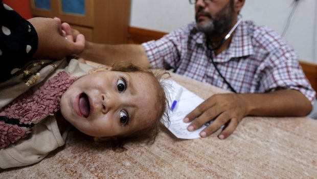 2024 08 18T111933Z 2027230148 RC2BI9A8AWW8 RTRMADP 5 ISRAEL PALESTINIANS GAZA POLIO 620x350.jpg